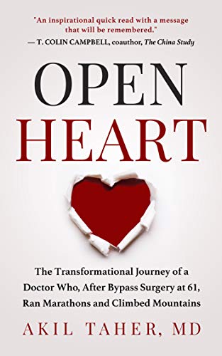 Open Heart by Akil Taher, MD