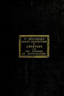 Graphic illustrations of abortion and the diseases of menstruation by A. B. Granville