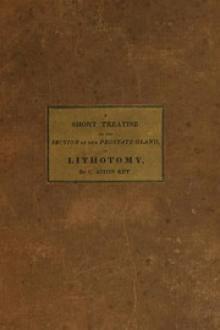 A Short Treatise on the Section of the Prostate Gland in Lithotomy by Charles Aston Key